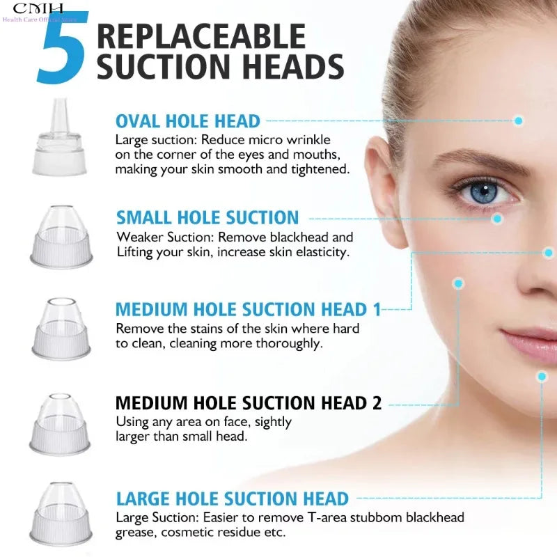 Advanced Pore Vacuum Extraction System