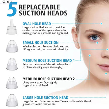 Advanced Pore Vacuum Extraction System
