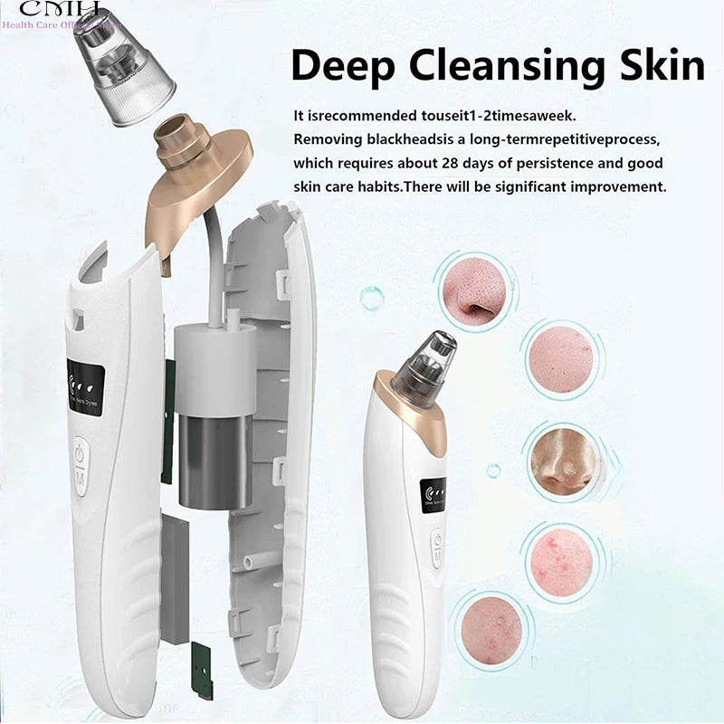 Advanced Pore Vacuum Extraction System