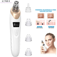 Advanced Pore Vacuum Extraction System