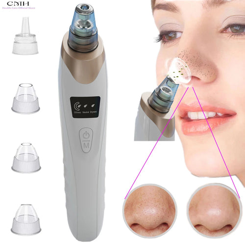 Advanced Pore Vacuum Extraction System